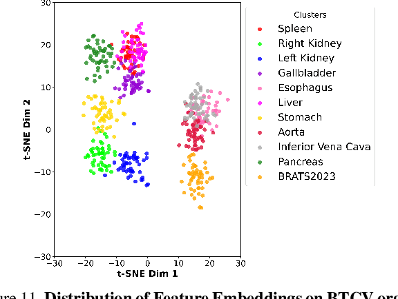 Figure 3 for UKBOB: One Billion MRI Labeled Masks for Generalizable 3D Medical Image Segmentation