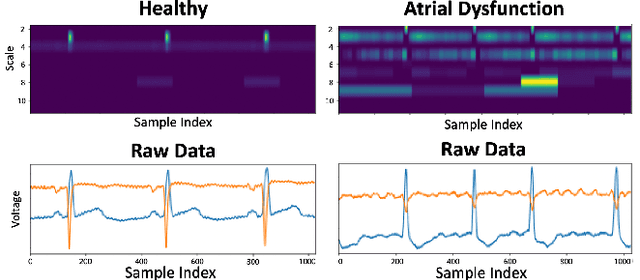 Figure 3 for Time Scale Network: A Shallow Neural Network For Time Series Data