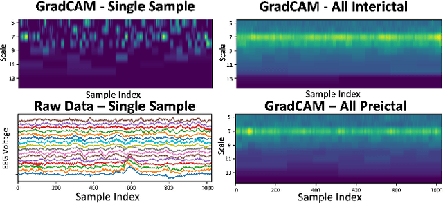 Figure 4 for Time Scale Network: A Shallow Neural Network For Time Series Data