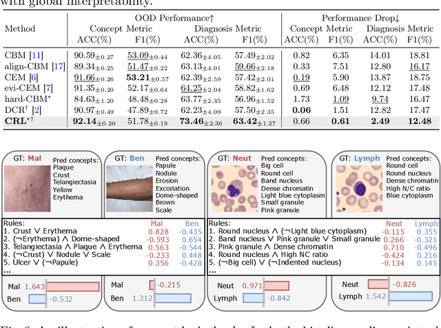 Figure 4 for Learning Concept-Driven Logical Rules for Interpretable and Generalizable Medical Image Classification