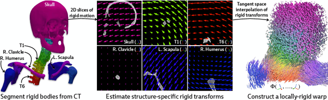 Figure 2 for PolyPose: Localizing Deformable Anatomy in 3D from Sparse 2D X-ray Images using Polyrigid Transforms