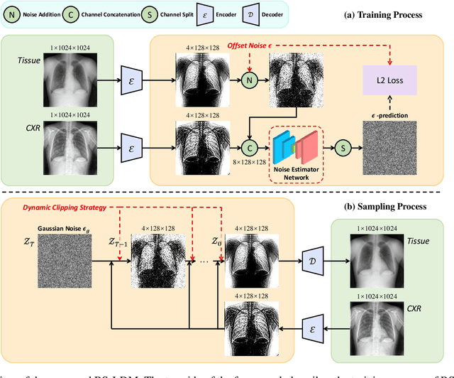 Figure 1 for BS-LDM: Effective Bone Suppression in High-Resolution Chest X-Ray Images with Conditional Latent Diffusion Models