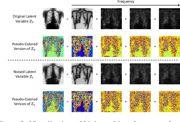 Figure 3 for BS-LDM: Effective Bone Suppression in High-Resolution Chest X-Ray Images with Conditional Latent Diffusion Models