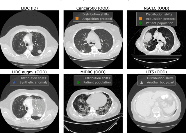 Figure 1 for Solving Sample-Level Out-of-Distribution Detection on 3D Medical Images