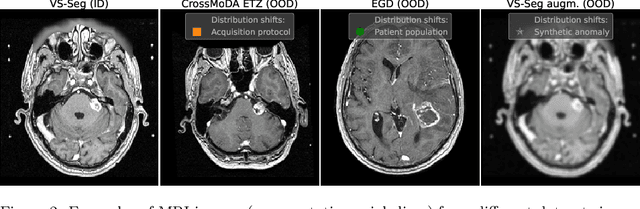 Figure 3 for Solving Sample-Level Out-of-Distribution Detection on 3D Medical Images