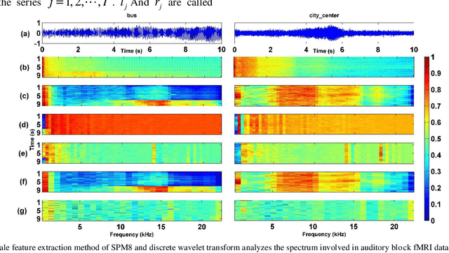 Figure 1 for Research on Feature Extraction Data Processing System For MRI of Brain Diseases Based on Computer Deep Learning