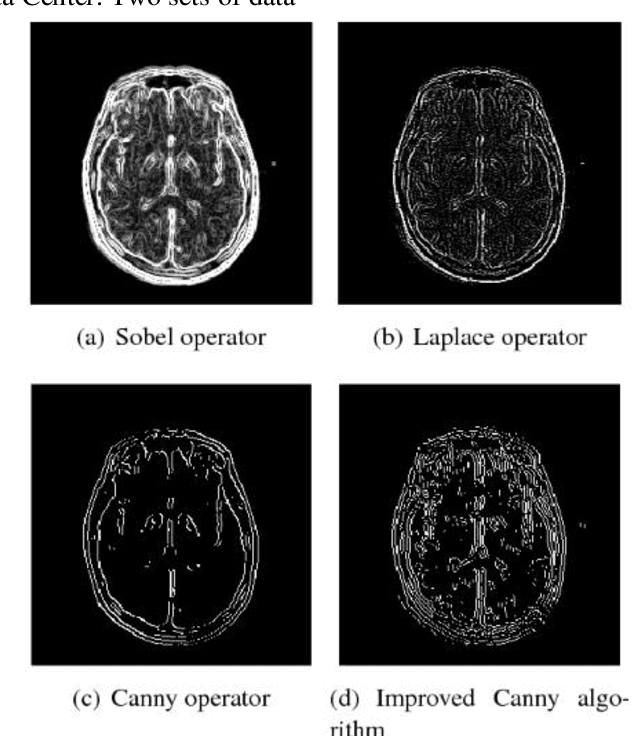 Figure 3 for Research on Feature Extraction Data Processing System For MRI of Brain Diseases Based on Computer Deep Learning