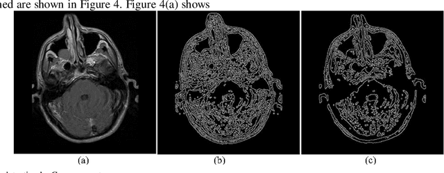 Figure 4 for Research on Feature Extraction Data Processing System For MRI of Brain Diseases Based on Computer Deep Learning