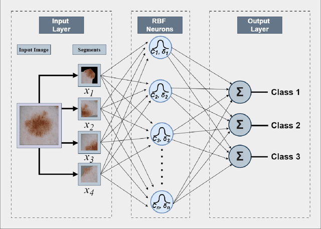 Figure 1 for Hybrid Interpretable Deep Learning Framework for Skin Cancer Diagnosis: Integrating Radial Basis Function Networks with Explainable AI