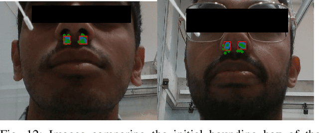 Figure 4 for Robotic Eye-in-hand Visual Servo Axially Aligning Nasopharyngeal Swabs with the Nasal Cavity