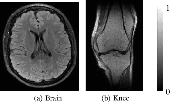 Figure 1 for A Complex Quasi-Newton Proximal Method for Image Reconstruction in Compressed Sensing MRI