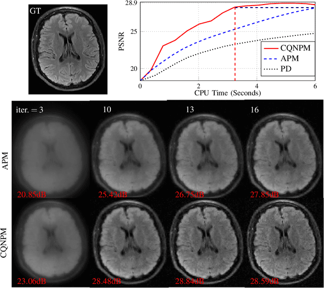 Figure 3 for A Complex Quasi-Newton Proximal Method for Image Reconstruction in Compressed Sensing MRI
