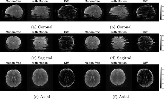 Figure 4 for A self-attention model for robust rigid slice-to-volume registration of functional MRI
