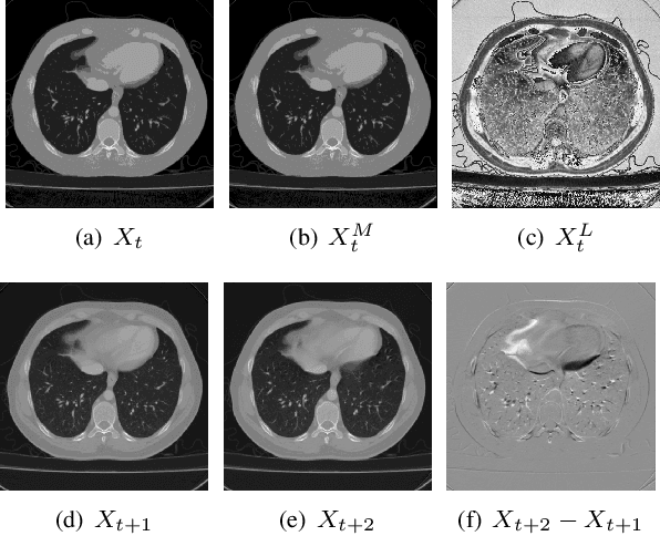 Figure 4 for Learning Lossless Compression for High Bit-Depth Volumetric Medical Image