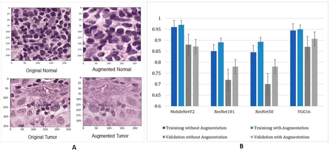 Figure 4 for Designing a Deep Learning-Driven Resource-Efficient Diagnostic System for Metastatic Breast Cancer: Reducing Long Delays of Clinical Diagnosis and Improving Patient Survival in Developing Countries