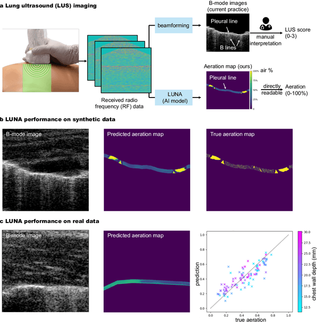 Figure 1 for Ultrasound Lung Aeration Map via Physics-Aware Neural Operators