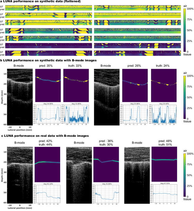 Figure 4 for Ultrasound Lung Aeration Map via Physics-Aware Neural Operators