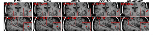 Figure 4 for DiffGEPCI: 3D MRI Synthesis from mGRE Signals using 2.5D Diffusion Model