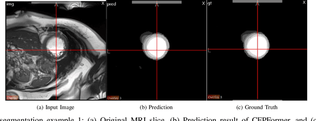 Figure 4 for CFPFormer: Feature-pyramid like Transformer Decoder for Segmentation and Detection