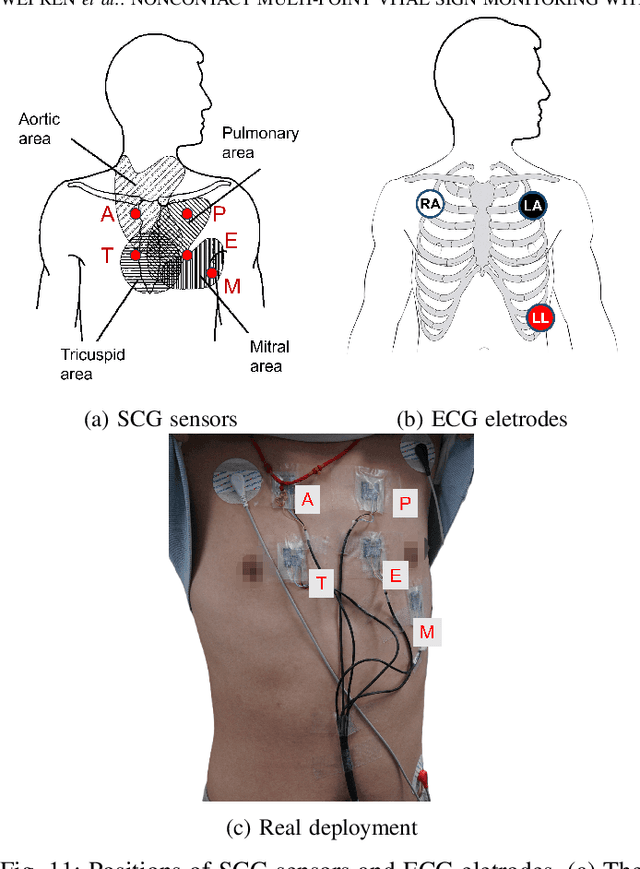 Figure 3 for Noncontact Multi-Point Vital Sign Monitoring with mmWave MIMO Radar