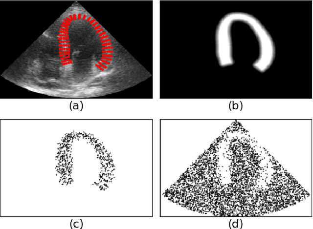 Figure 1 for Generation of realistic cardiac ultrasound sequences with ground truth motion and speckle decorrelation