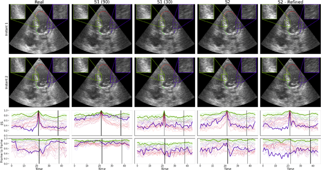 Figure 3 for Generation of realistic cardiac ultrasound sequences with ground truth motion and speckle decorrelation