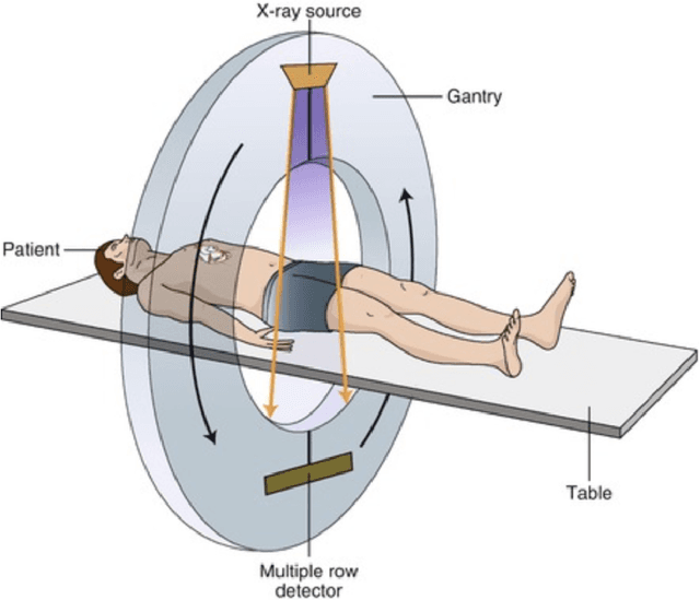 Figure 1 for Medical Image Segmentation with Belief Function Theory and Deep Learning