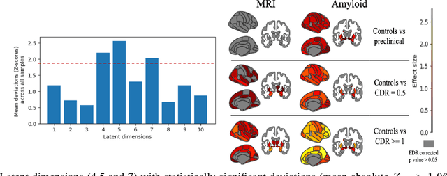 Figure 4 for Improving Normative Modeling for Multi-modal Neuroimaging Data using mixture-of-product-of-experts variational autoencoders