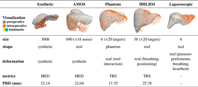 Figure 2 for PIVOTS: Aligning unseen Structures using Preoperative to Intraoperative Volume-To-Surface Registration for Liver Navigation