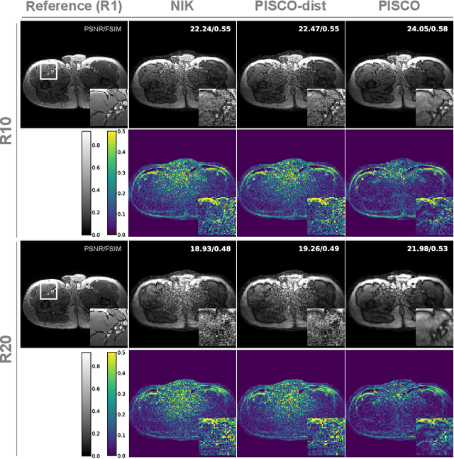 Figure 4 for PISCO: Self-Supervised k-Space Regularization for Improved Neural Implicit k-Space Representations of Dynamic MRI