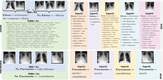 Figure 3 for Distilling BlackBox to Interpretable models for Efficient Transfer Learning