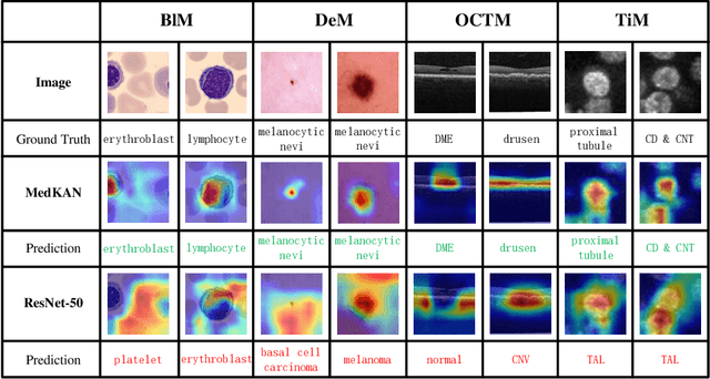 Figure 3 for MedKAN: An Advanced Kolmogorov-Arnold Network for Medical Image Classification