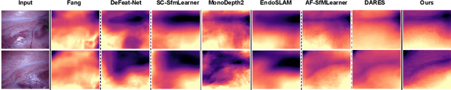 Figure 3 for EndoSfM3D: Learning to 3D Reconstruct Any Endoscopic Surgery Scene using Self-supervised Foundation Model