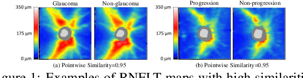 Figure 1 for Harvard Glaucoma Detection and Progression: A Multimodal Multitask Dataset and Generalization-Reinforced Semi-Supervised Learning