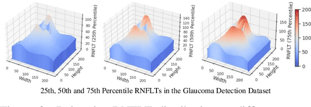 Figure 3 for Harvard Glaucoma Detection and Progression: A Multimodal Multitask Dataset and Generalization-Reinforced Semi-Supervised Learning