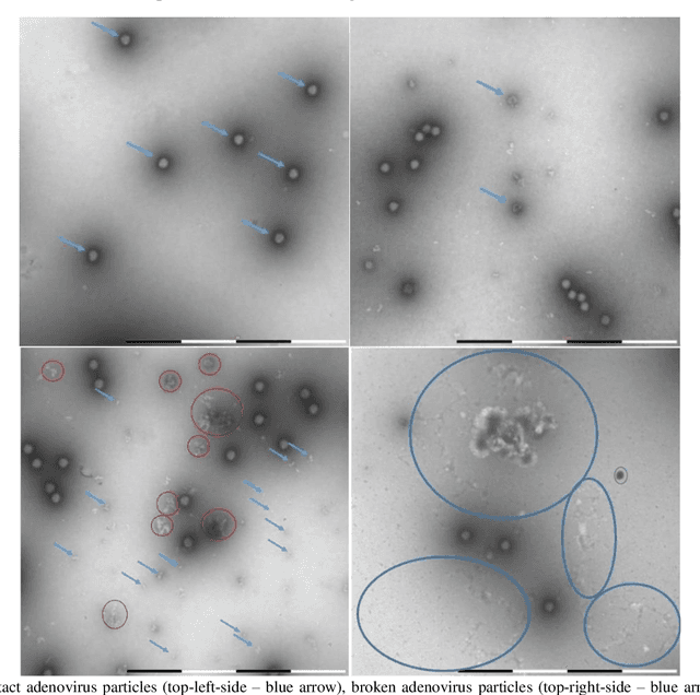 Figure 1 for Convolutional Neural Networks for Automatic Detection of Intact Adenovirus from TEM Imaging with Debris, Broken and Artefacts Particles