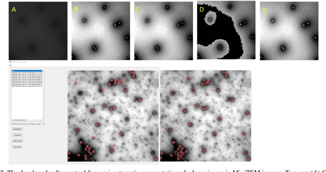 Figure 2 for Convolutional Neural Networks for Automatic Detection of Intact Adenovirus from TEM Imaging with Debris, Broken and Artefacts Particles