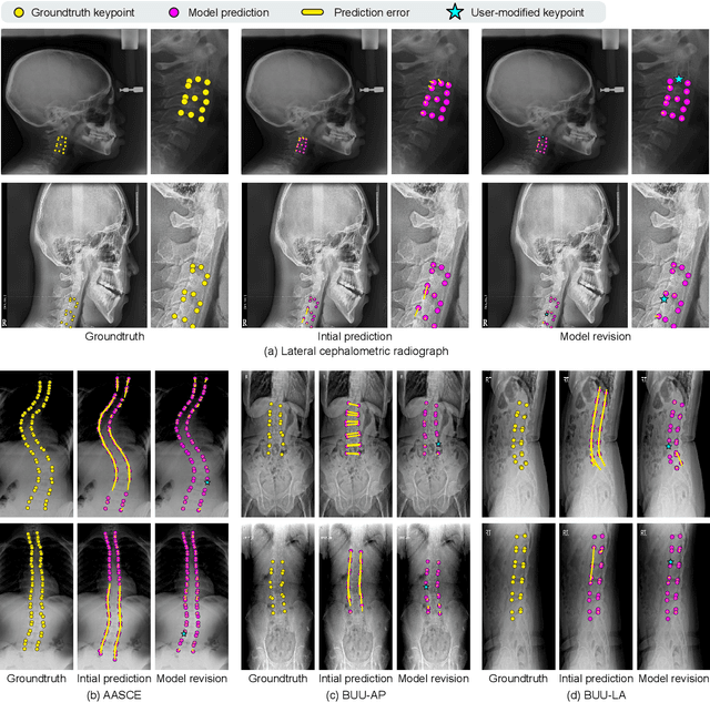 Figure 3 for Attend-and-Refine: Interactive keypoint estimation and quantitative cervical vertebrae analysis for bone age assessment