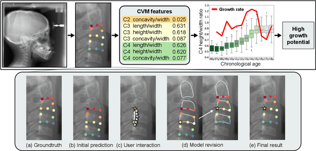 Figure 1 for Attend-and-Refine: Interactive keypoint estimation and quantitative cervical vertebrae analysis for bone age assessment