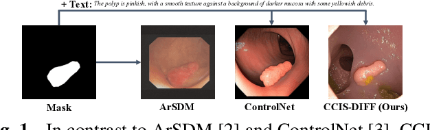 Figure 1 for CCIS-Diff: A Generative Model with Stable Diffusion Prior for Controlled Colonoscopy Image Synthesis