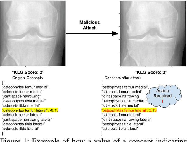 Figure 1 for Understanding and Enhancing Robustness of Concept-based Models