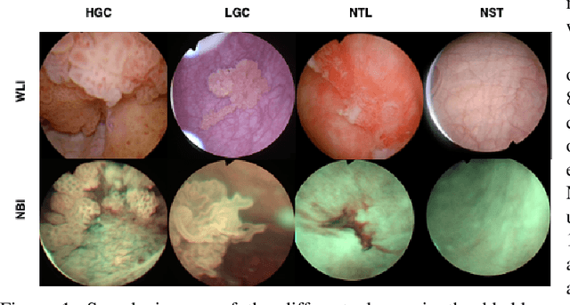 Figure 1 for Semi-supervised GAN for Bladder Tissue Classification in Multi-Domain Endoscopic Images