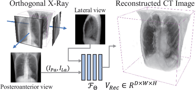 Figure 1 for X-Recon: Learning-based Patient-specific High-Resolution CT Reconstruction from Orthogonal X-Ray Images
