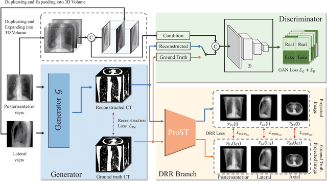Figure 2 for X-Recon: Learning-based Patient-specific High-Resolution CT Reconstruction from Orthogonal X-Ray Images