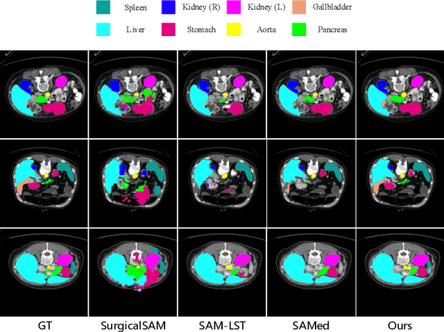 Figure 1 for PGP-SAM: Prototype-Guided Prompt Learning for Efficient Few-Shot Medical Image Segmentation