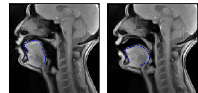 Figure 1 for Complete reconstruction of the tongue contour through acoustic to articulatory inversion using real-time MRI data