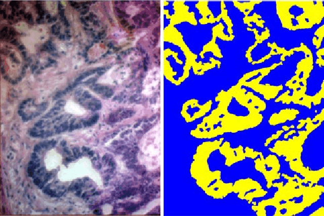 Figure 3 for A Hyperspectral Imaging Dataset and Methodology for Intraoperative Pixel-Wise Classification of Metastatic Colon Cancer in the Liver