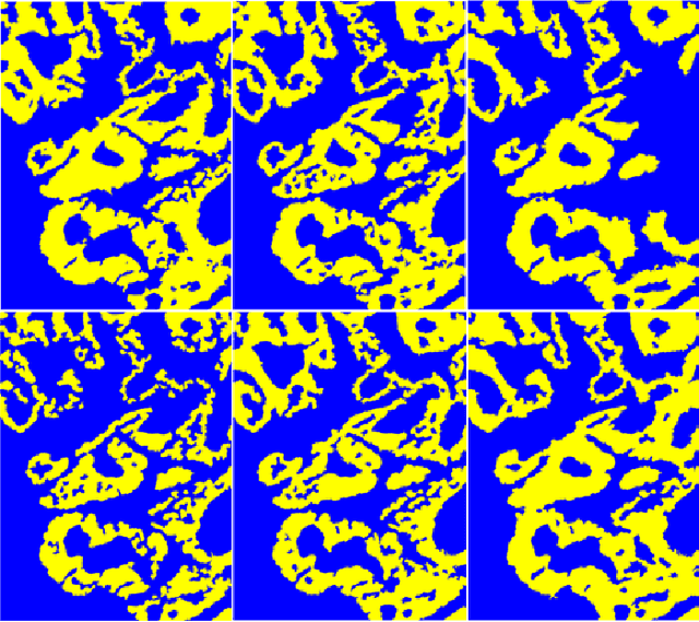 Figure 4 for A Hyperspectral Imaging Dataset and Methodology for Intraoperative Pixel-Wise Classification of Metastatic Colon Cancer in the Liver
