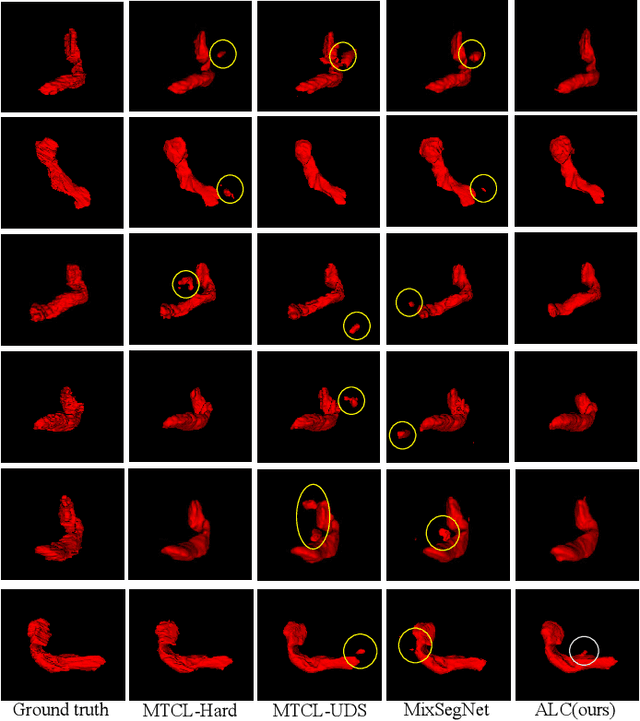 Figure 4 for Adaptive Label Correction for Robust Medical Image Segmentation with Noisy Labels
