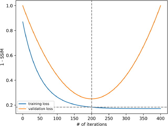 Figure 4 for Accelerated Patient-specific Non-Cartesian MRI Reconstruction using Implicit Neural Representations